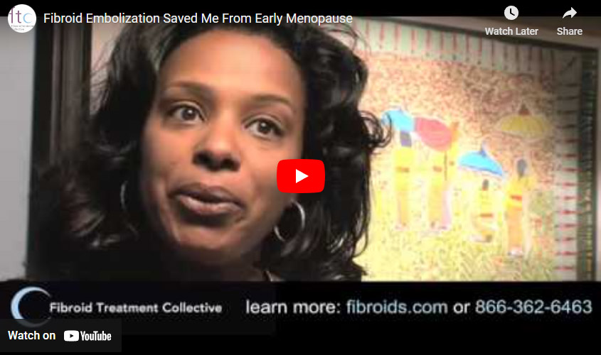 Fibroid Embolization Saved Me From Early Menopause