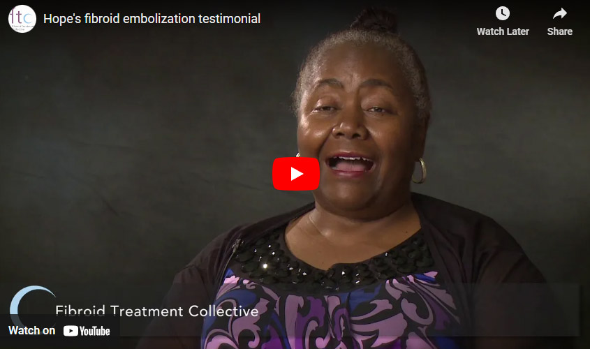 Hope's fibroid embolization testimonial