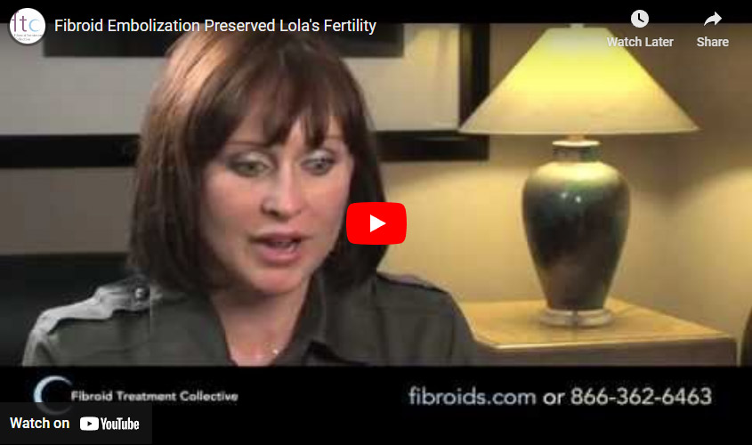 Fibroid Embolization Preserved Lola's Fertility