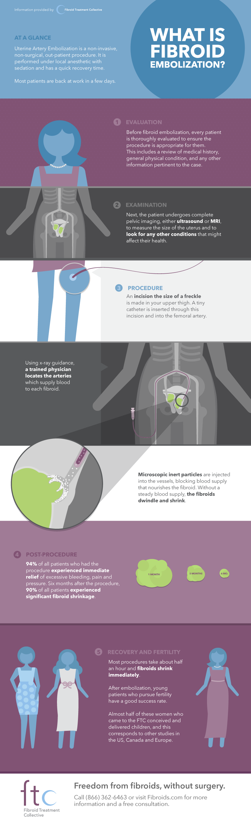 what-is-fibroid-embolization-infographic