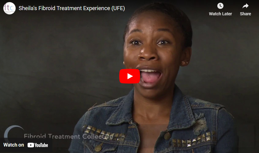 Sheila's Fibroid Treatment Experience (UFE)