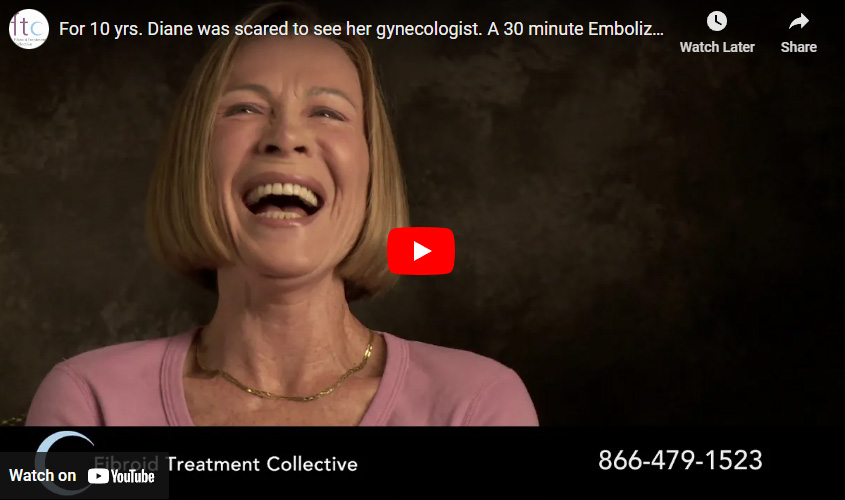 For 10 yrs. Diane was scared to see her gynecologist. A 30 minute Embolization made her fearless