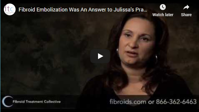 Youtube thumbnail for video Fibroids Embolization